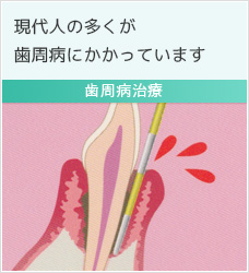 歯周病